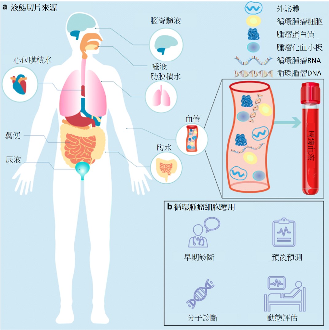 癌症精準醫學新趨勢: 循環腫瘤細胞檢測